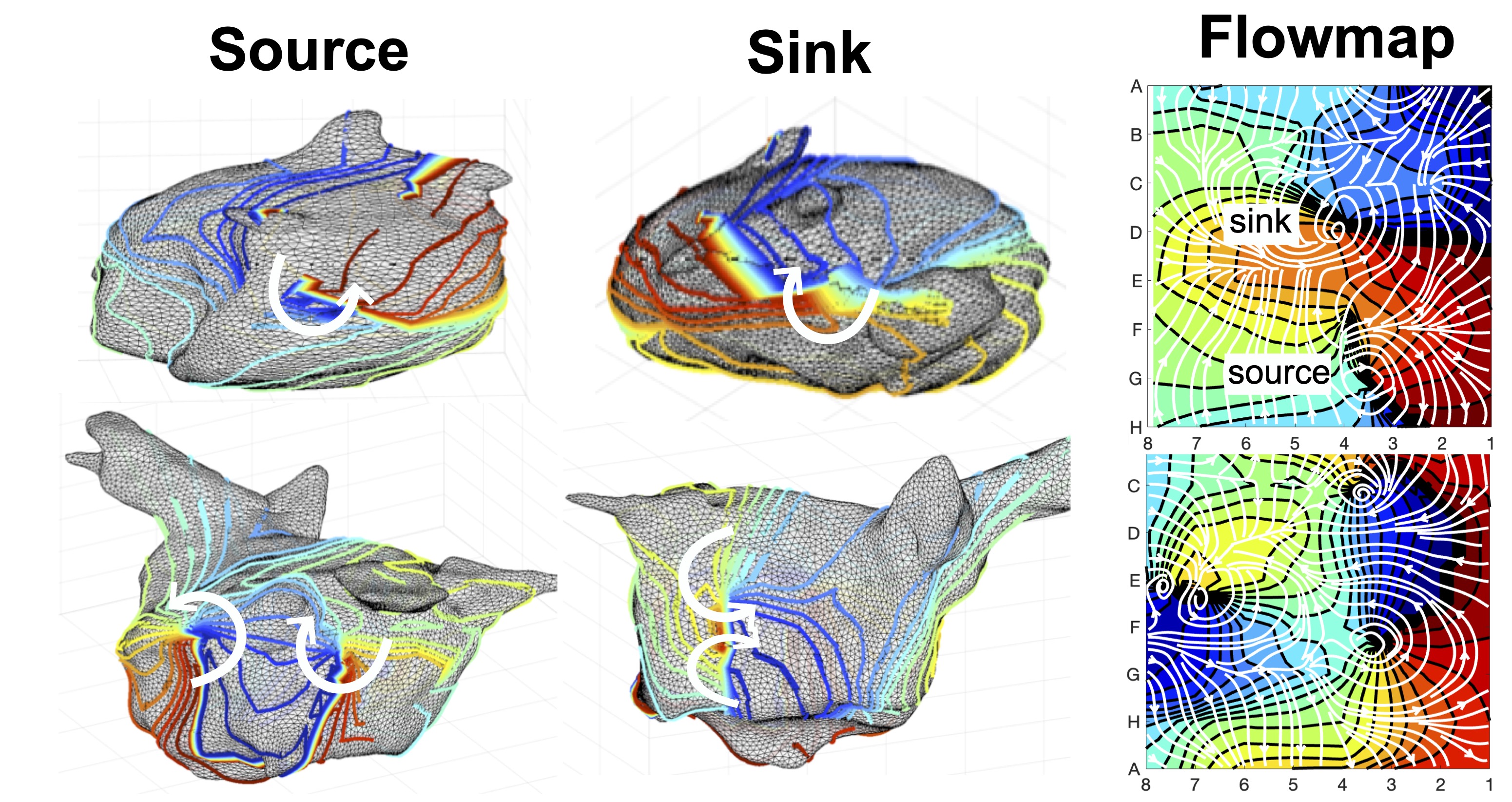 Atrial fibrillation and arrhythmia mapping